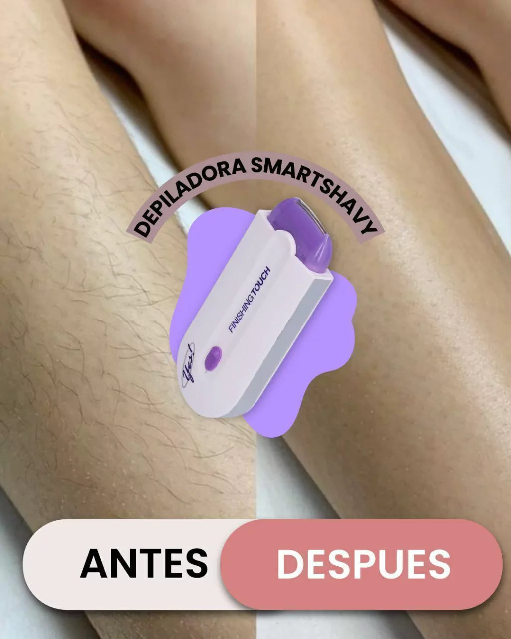 Depilación Laser Rápida e indolora ✨