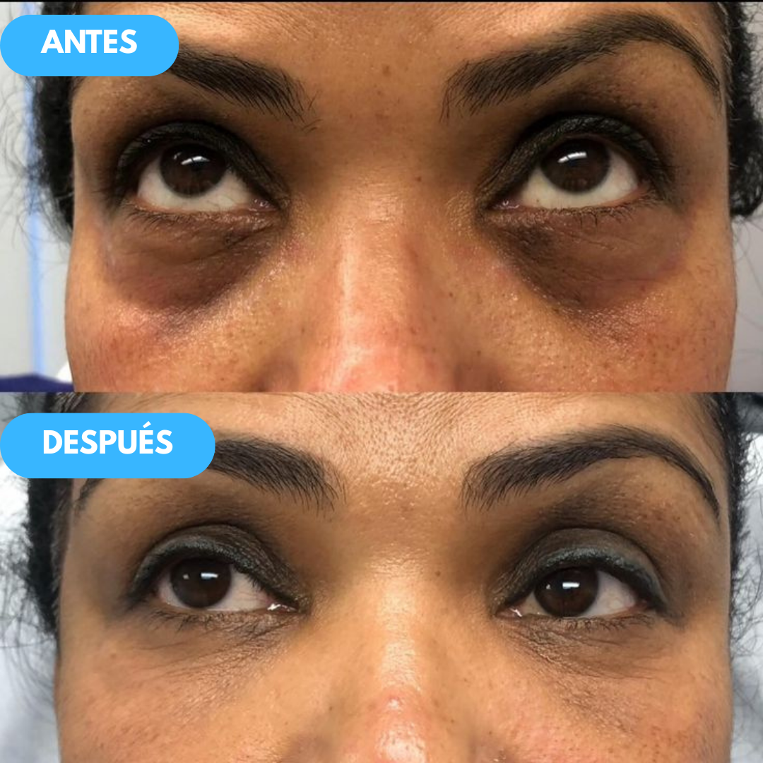 NidaGlow™ – Crema Antiedad con Colágeno y Efecto Rejuvenecedor 2x1 OFERTA