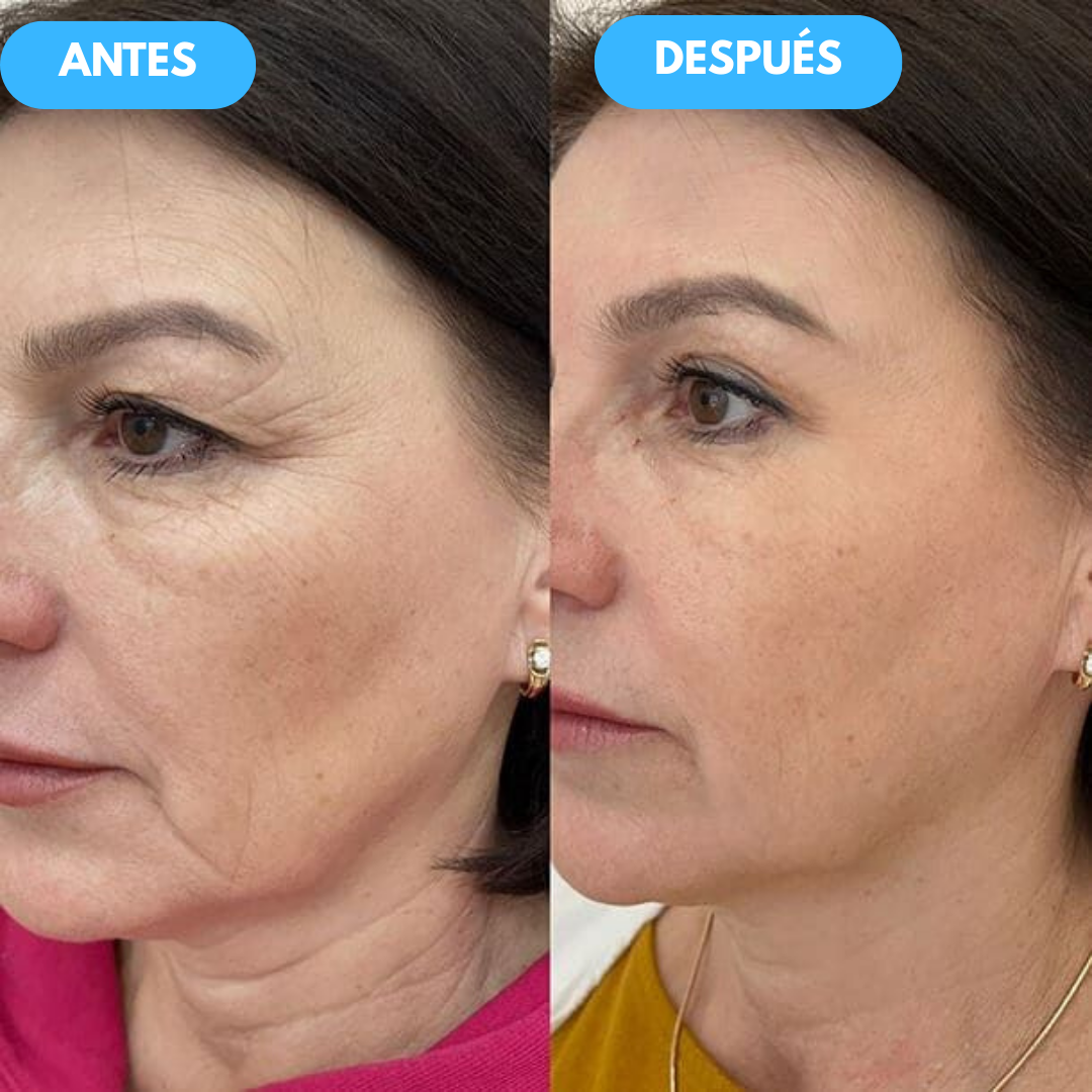 NidaGlow™ – Crema Antiedad con Colágeno y Efecto Rejuvenecedor 2x1 OFERTA