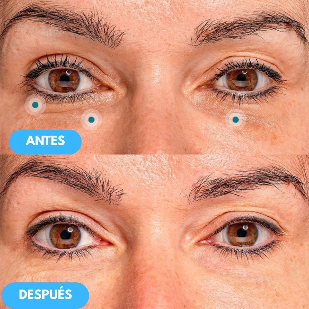 NidaGlow™ – Crema Antiedad con Colágeno y Efecto Rejuvenecedor 2x1 OFERTA