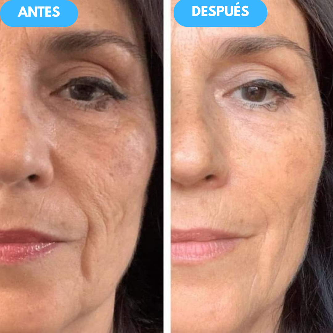 NidaGlow™ – Crema Antiedad con Colágeno y Efecto Rejuvenecedor 2x1 OFERTA