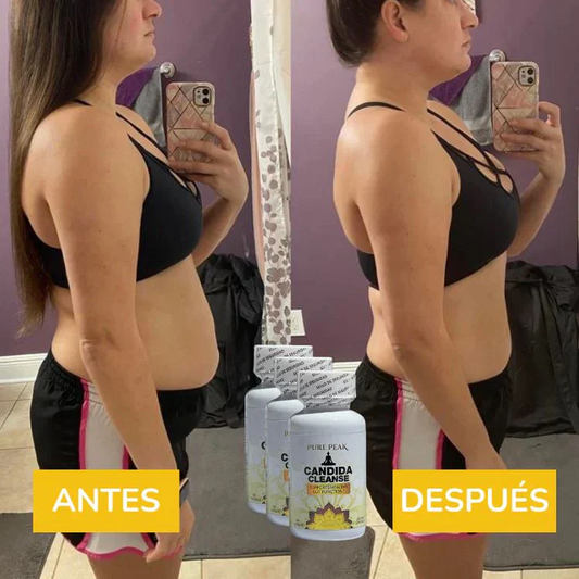 Candida Cleanse® – Controla Antojos, Desinflama Abdomen y Combate Cansancio