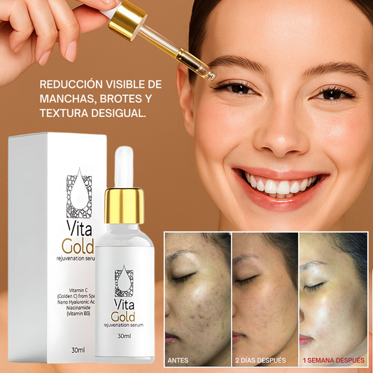 Vita Gold® – Vuelve a Sentir tu Piel Firme, Joven y Radiante