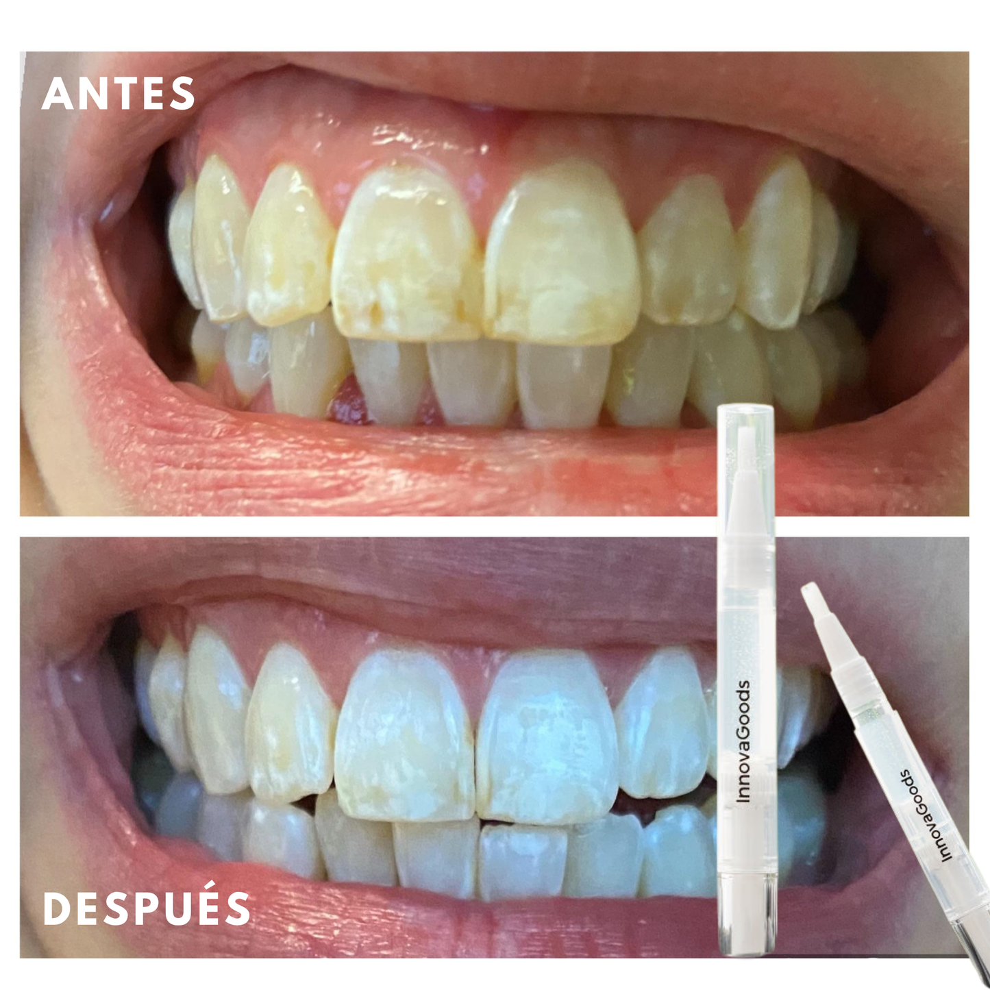 Smile White™ — El Lápiz Blanqueador 4X Más Potente (Promo 2x1)