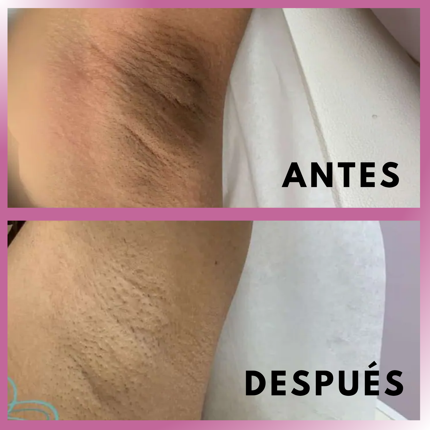 OFERTA LIMITADA 2x1 — Aceite 100% Natural para una Piel Íntima que Resplandece con Cuidado