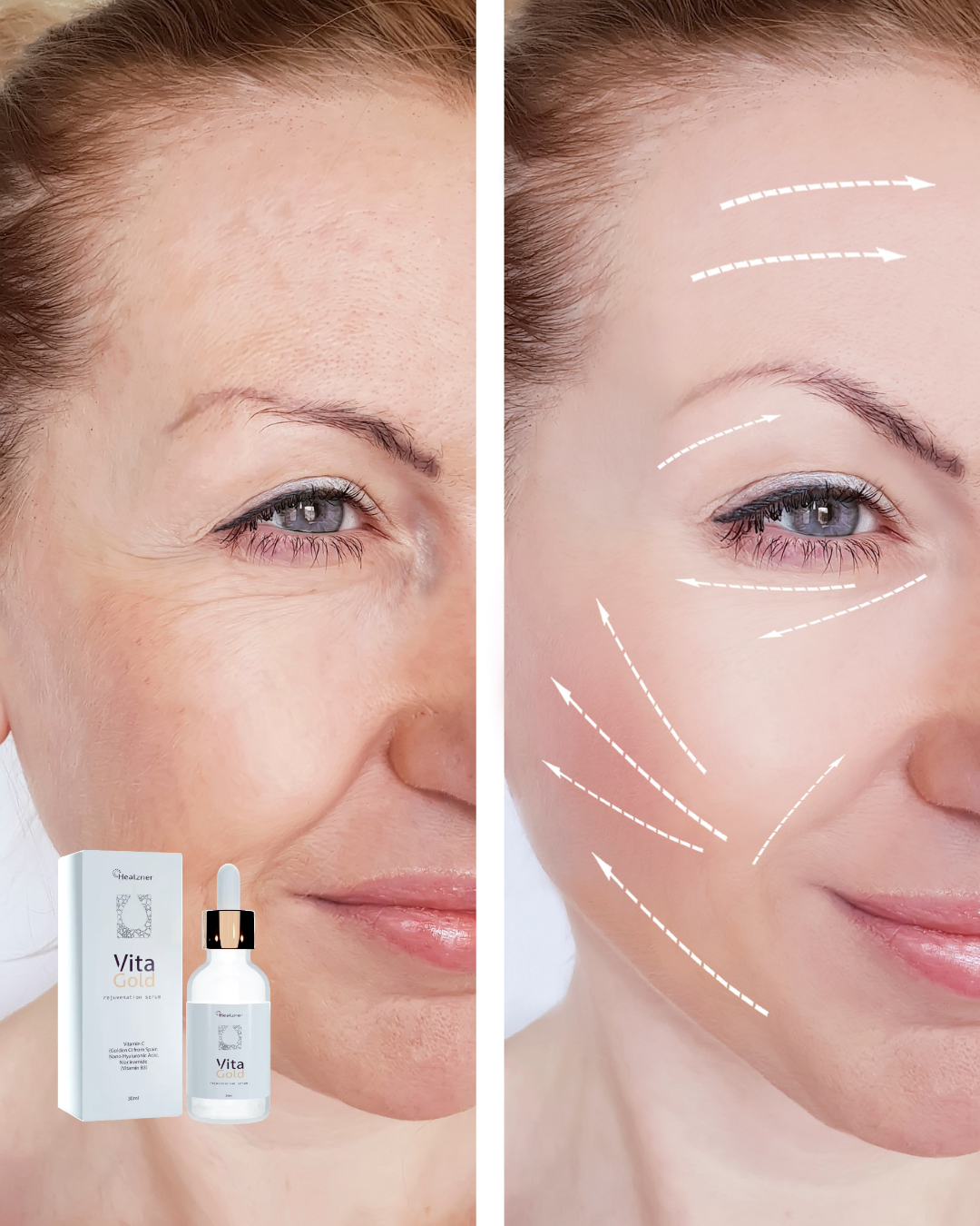 VitaGold Crema Anti-Edad