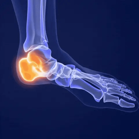 ComfyFeet Pro™ – Plantillas Ortopédicas de Alivio Total para Pies Cansados