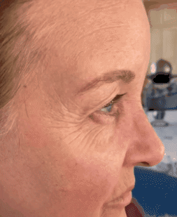 Crema Facial Vanera