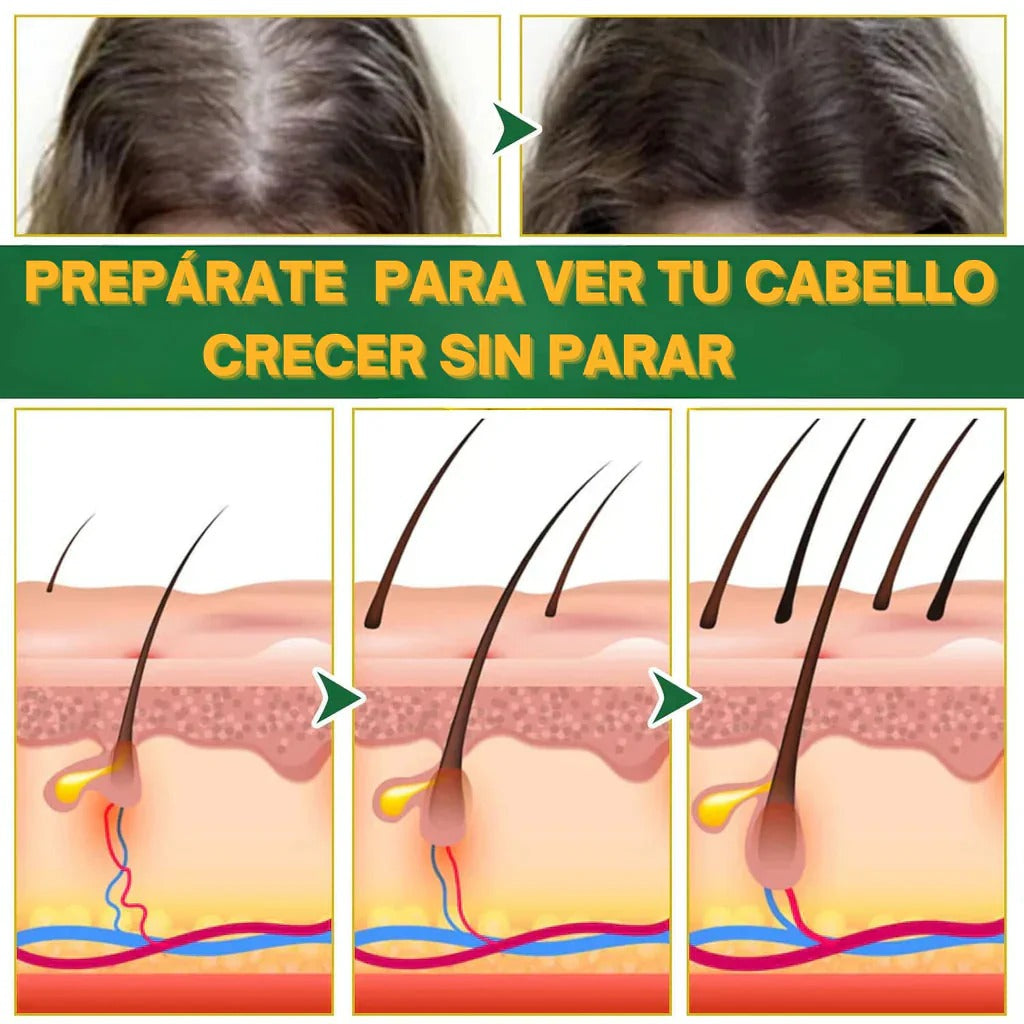 OUHOE Hair Elixir – Recupera tu Cabello Naturalmente