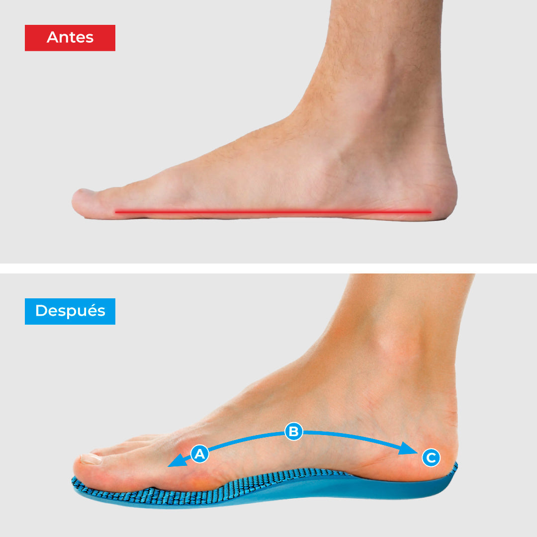 ComfyFeet Pro™ – Plantillas Ortopédicas de Alivio Total para Pies Cansados