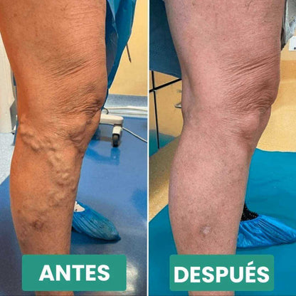 Masajeador VitalRelax® + Guia para tu bienistar