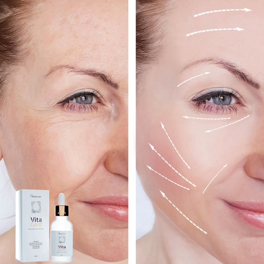 Vitagold - 20 AÑOS MENOS EN 5 MINUTOS