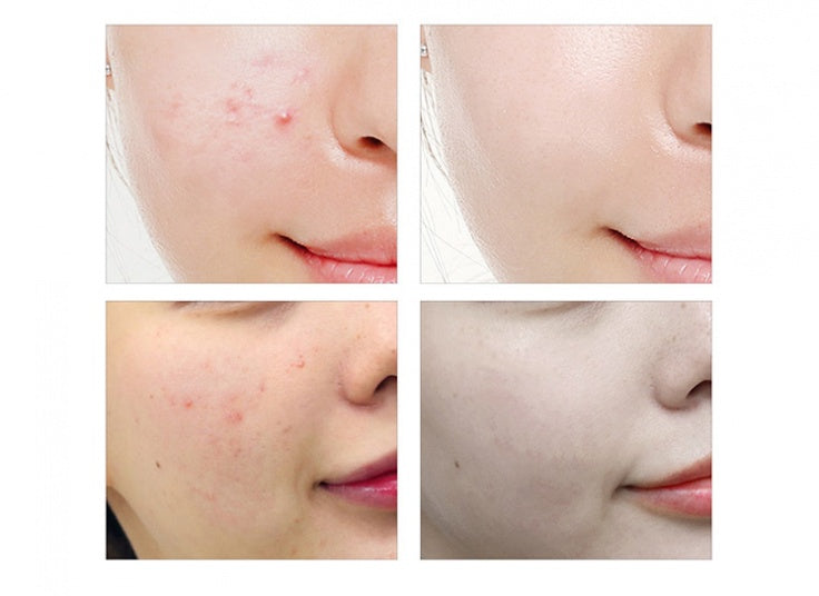 Ginseng Glow-Up Serum – 2x1 OFFER! 49% OFF today!