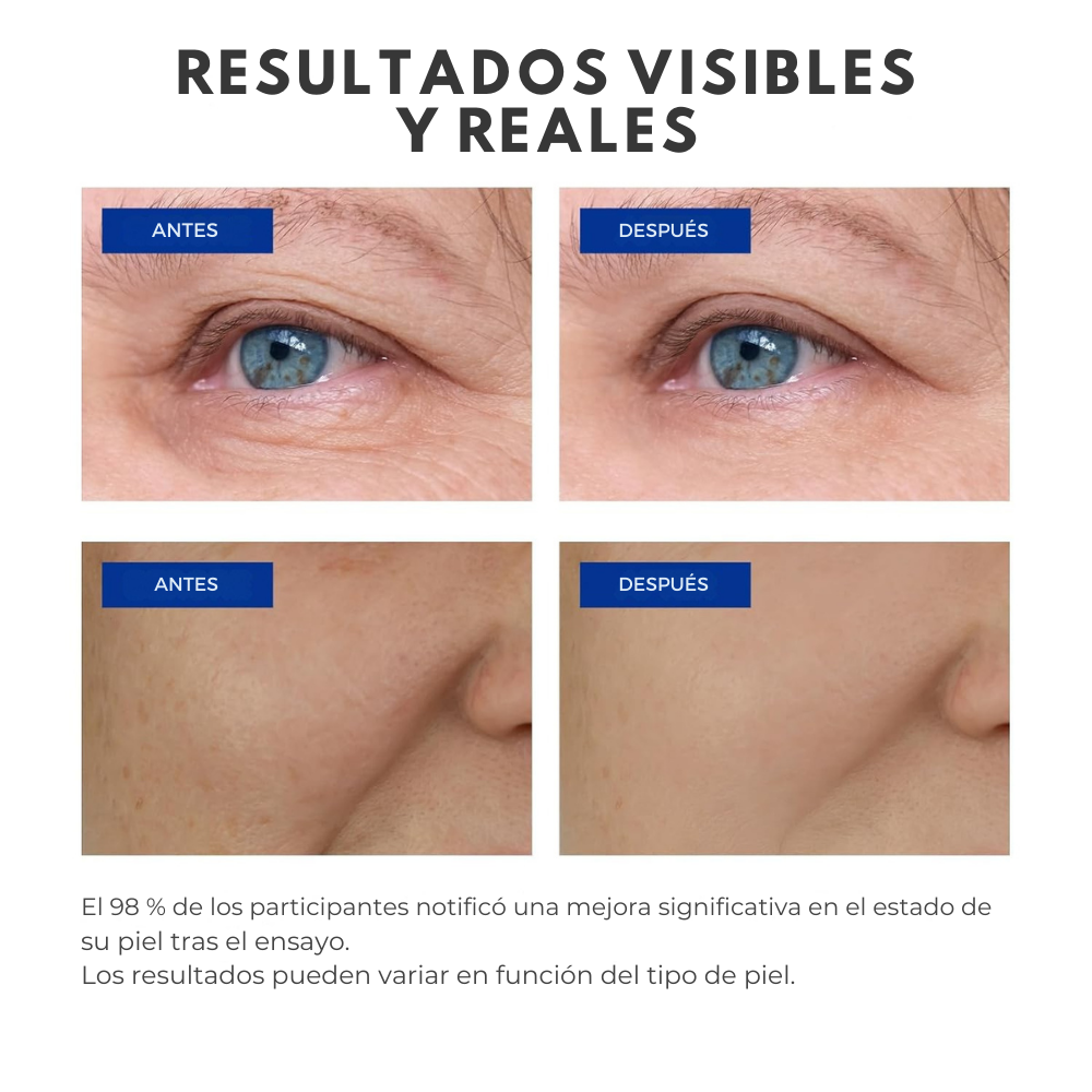 VitaGold - Crema Antiedad