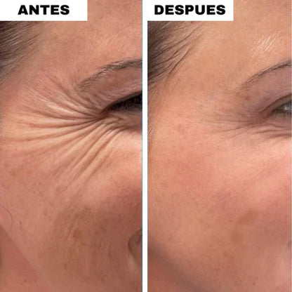 Colágeno Stick Reafirmante – Tu Nuevo Secreto Antiarrugas