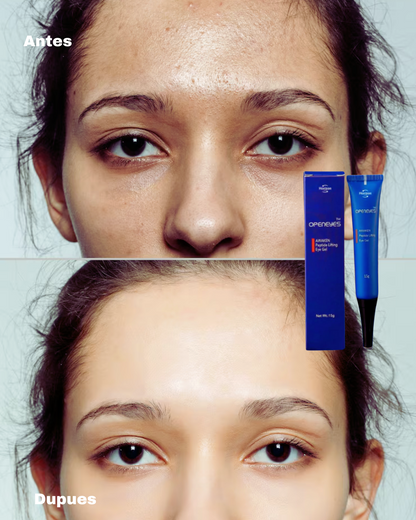 Crema para Eliminar Ojeras