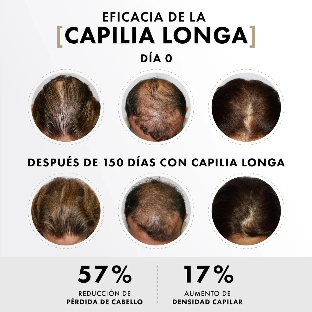 Activador Capilar para Crecimiento con Células Madre y Factores de Crecimiento