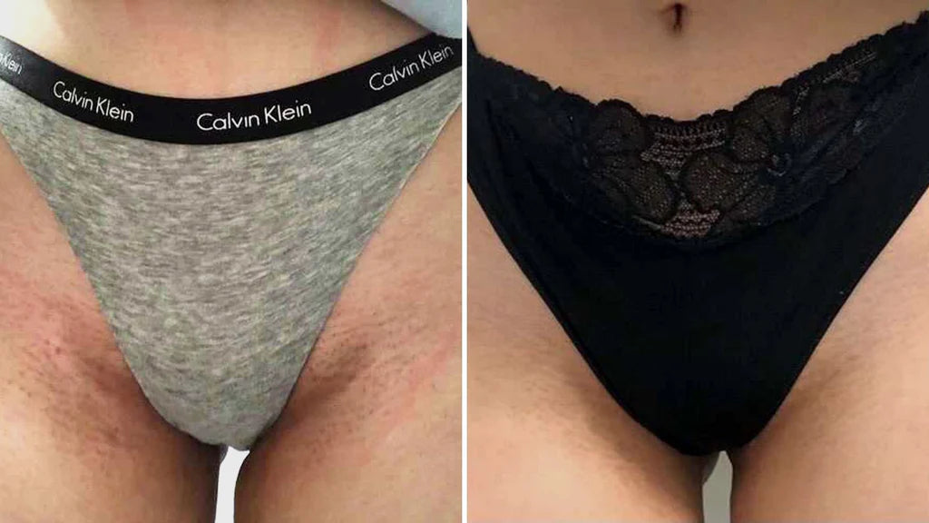 Adiós a la irritación por afeitado, hola a la confianza en uno mismo. OFERTA 2x1