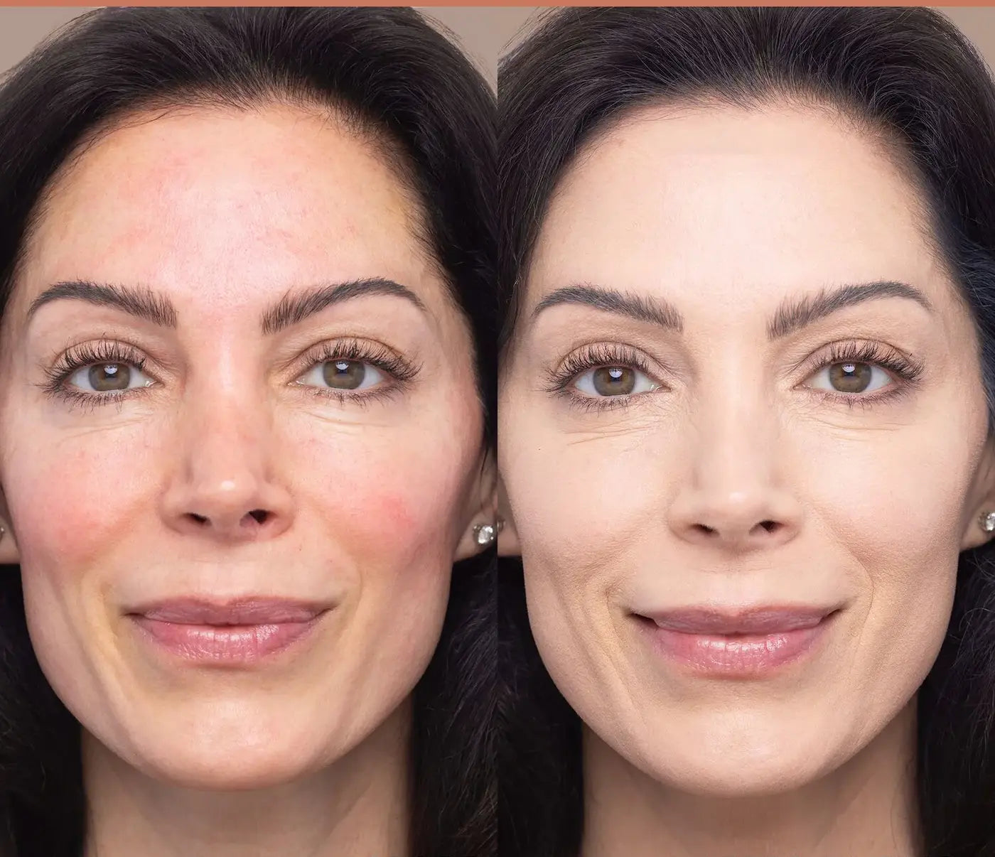 BASE LÍQUIDA CON VITAMINA C REJUVENESCEDOR + ENVÍO GRATIS + 49% DE DESCUENTO