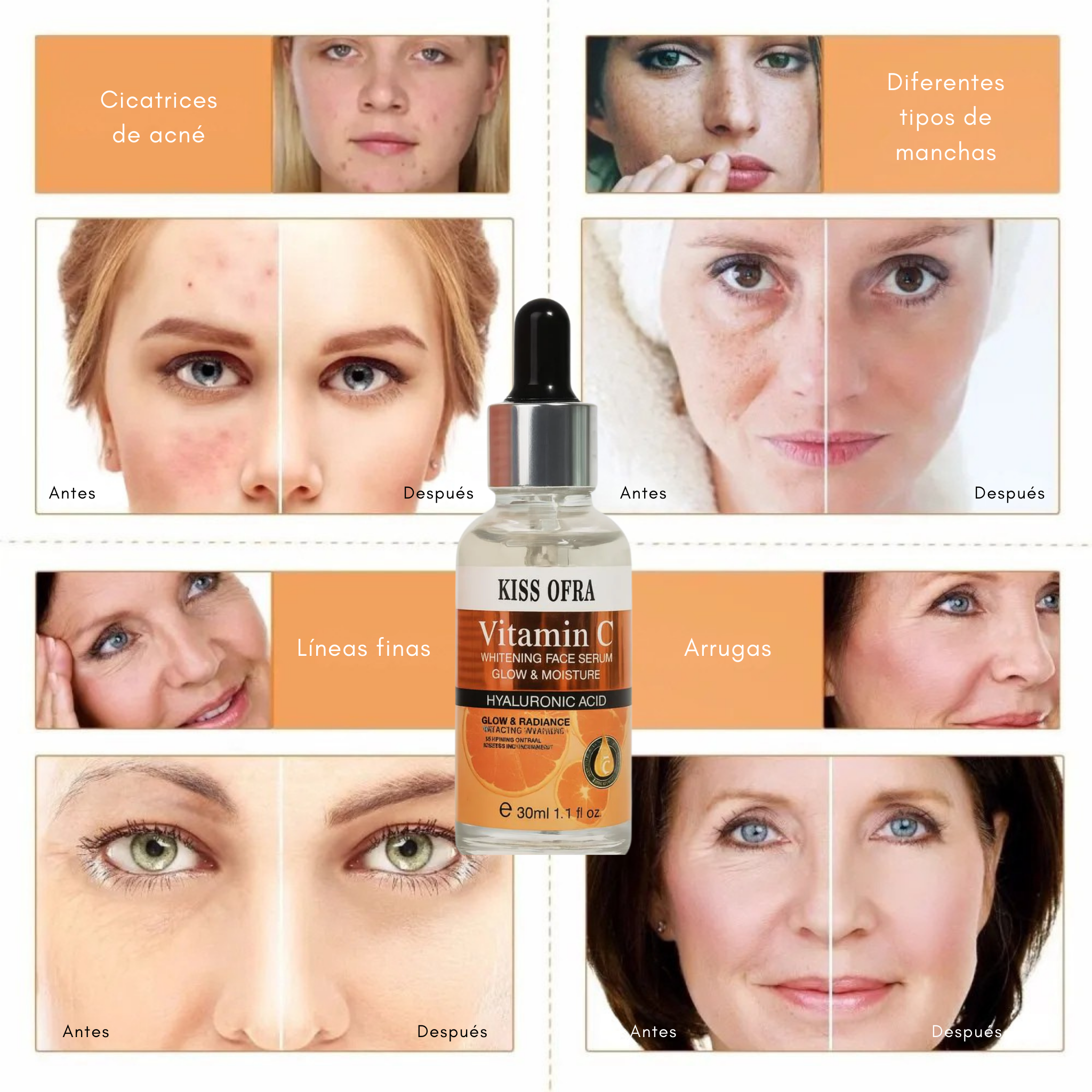 Suero Facial Vitamina C – Adiós Manchas, Hola Piel Radiante ✨