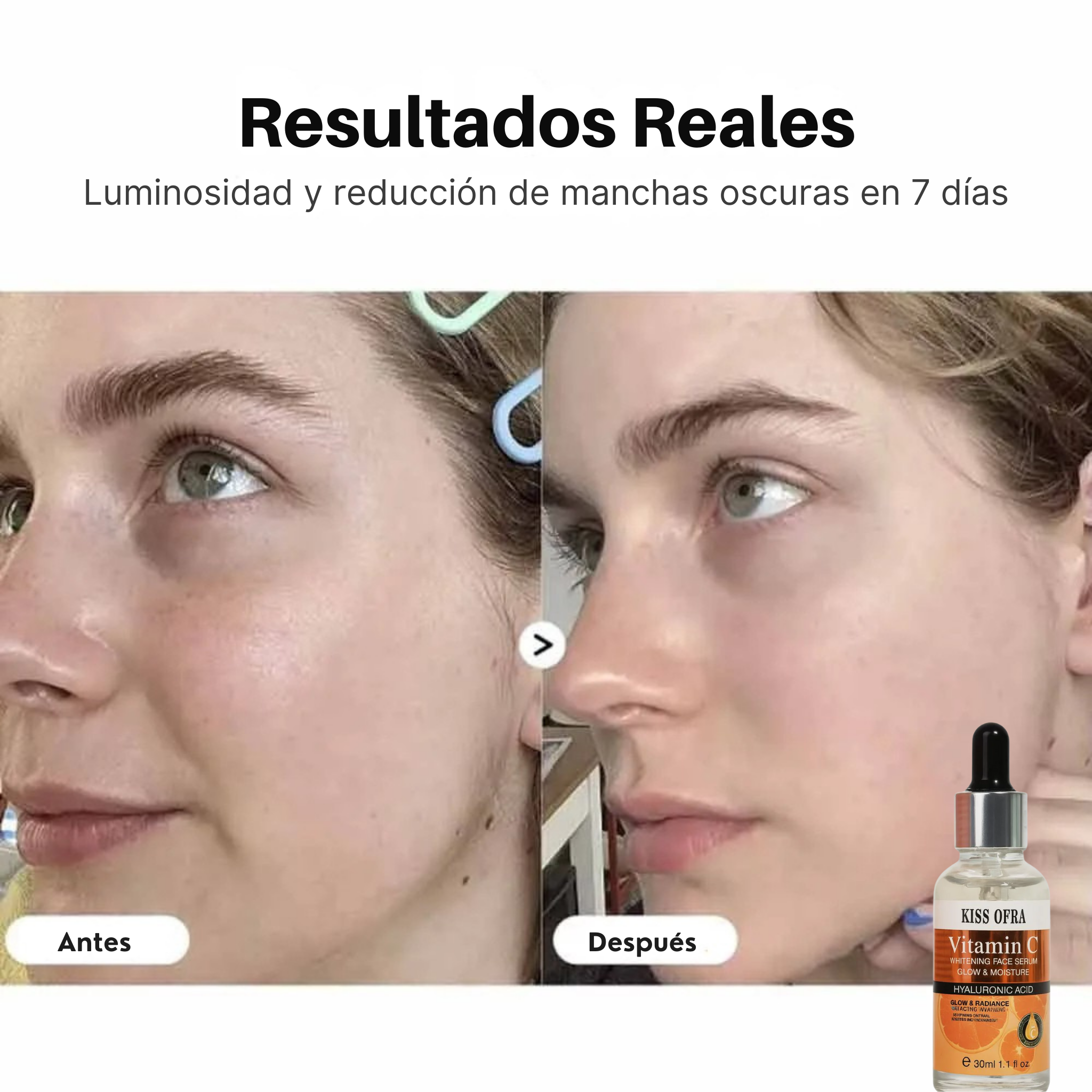 Suero Facial Vitamina C – Adiós Manchas, Hola Piel Radiante ✨