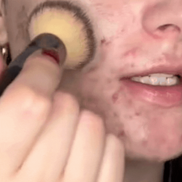 Base Líquida 4 en 1 – Cubre Acné y Deja Tu Piel Impecable