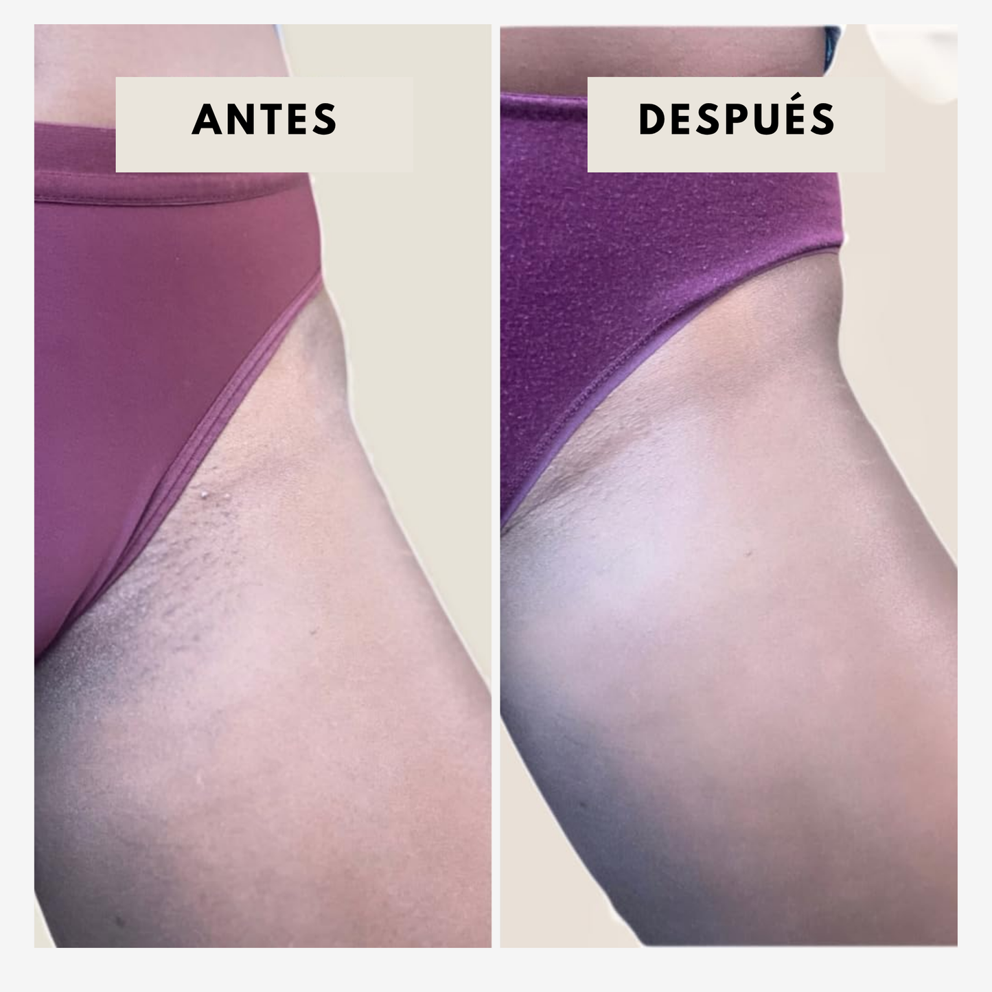 OFERTA LIMITADA 2x1 — Aceite 100% Natural para una Piel Íntima que Resplandece con Cuidado