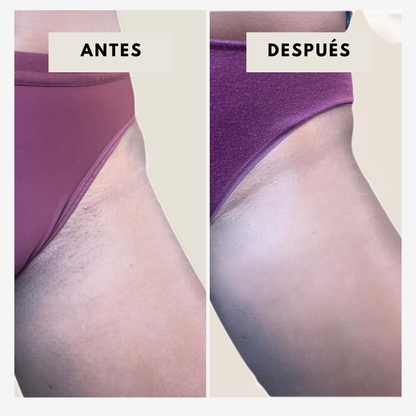 OFERTA LIMITADA 2x1 — Aceite 100% Natural para una Piel Íntima que Resplandece con Cuidado