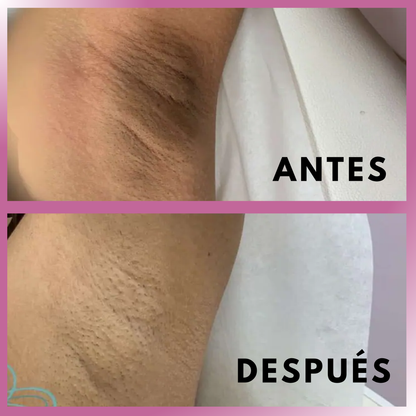 OFERTA LIMITADA 2x1 — Aceite 100% Natural para una Piel Íntima que Resplandece con Cuidado