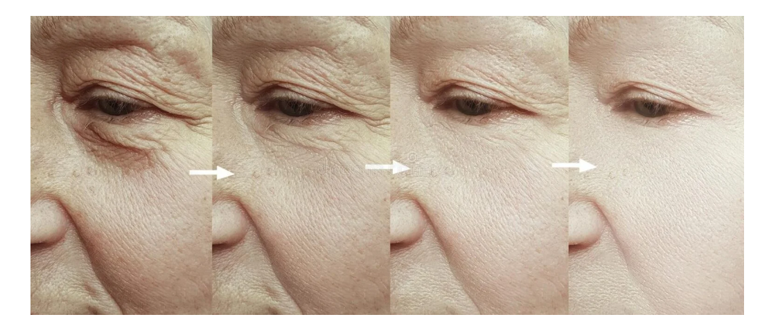 Crema Facial Vanera