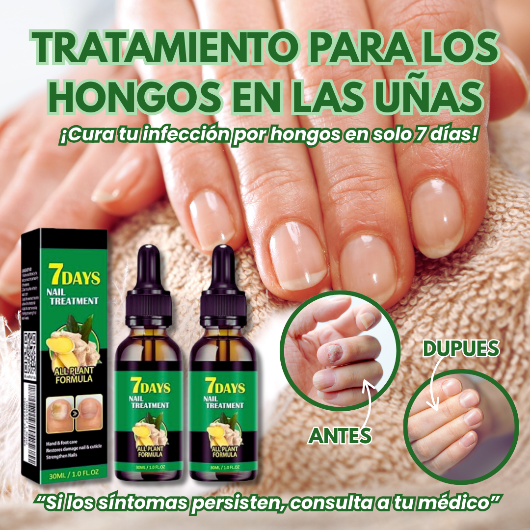Tratamiento para los hongos en las uñas – TiendaLujosa