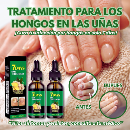 Tratamiento para los hongos en las uñas