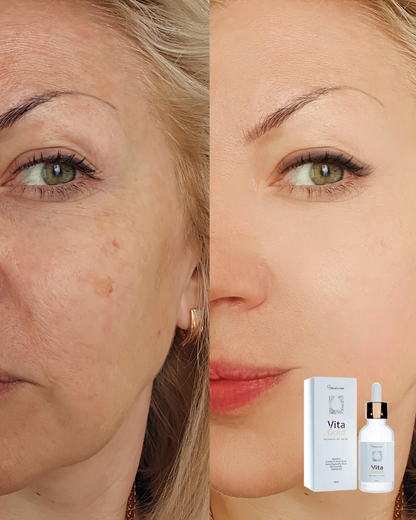 VitaGold Crema Anti-Edad