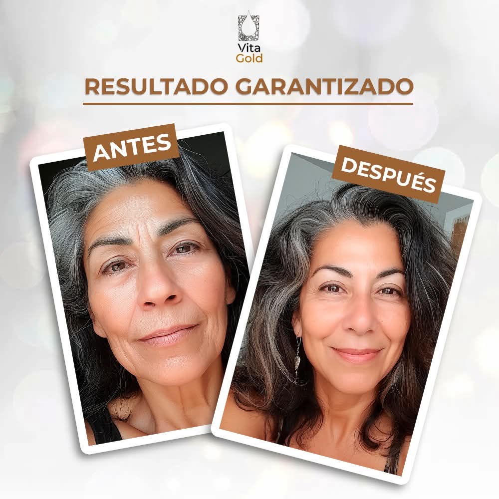 Vitagold - 20 AÑOS MENOS EN 5 MINUTOS