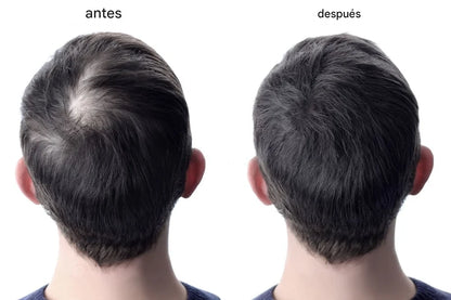 OUHOE Hair Elixir – Recupera tu Cabello Naturalmente