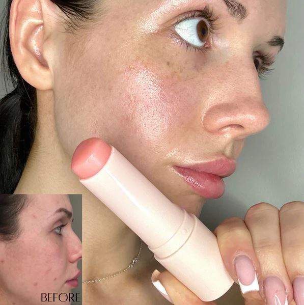 RevitaLift Balm™ – Hidratación & Firmeza