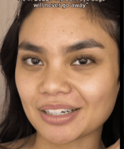 Crema para Eliminar Ojeras