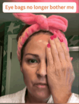 Crema para Eliminar Ojeras