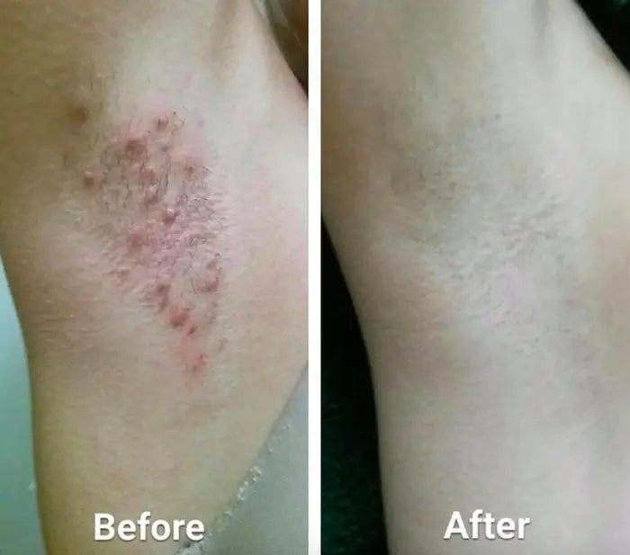 Adiós a la irritación por afeitado, hola a la confianza en uno mismo. OFERTA 2x1