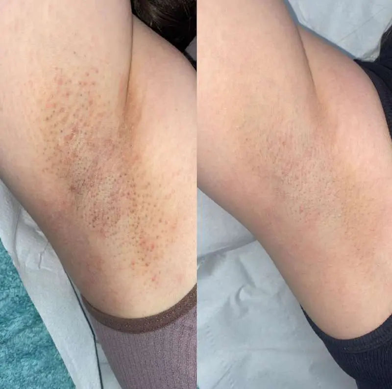 Adiós a la irritación por afeitado, hola a la confianza en uno mismo. OFERTA 2x1