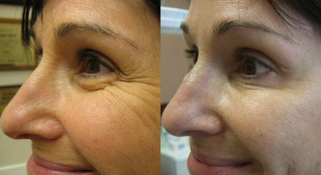 Retime™ – Crema Reafirmante Antiarrugas