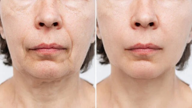LA CREMA ANTI-EDAD ITALIANA QUE BORRA AÑOS — SIN AGUJAS, SIN CIRUGÍA