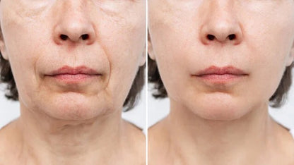 LA CREMA ANTI-EDAD ITALIANA QUE BORRA AÑOS — SIN AGUJAS, SIN CIRUGÍA