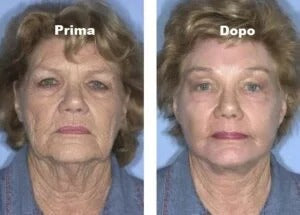 Q10 Mask – Piel Joven al Instante en 5 Minutos