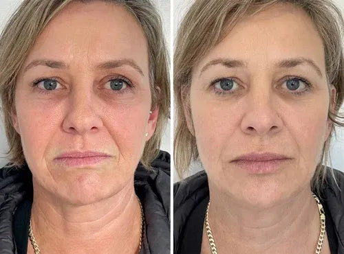 Retime™ – Crema Reafirmante Antiarrugas