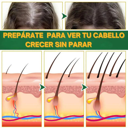 OUHOE Hair Elixir – Recupera tu Cabello Naturalmente