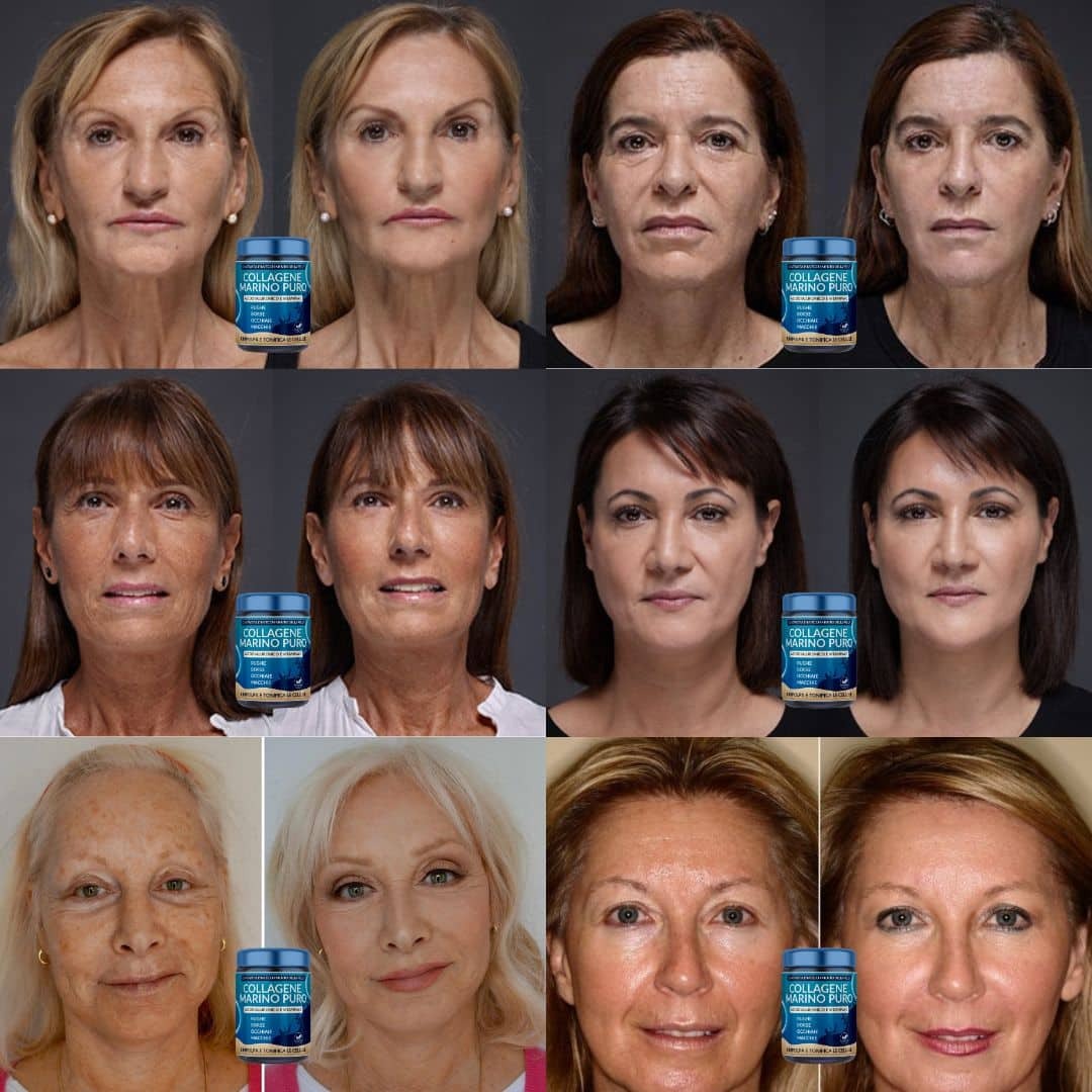 Rejuvenece en 9 Días: Colágeno Anti Age para Arrugas, Bolsas y Manchas