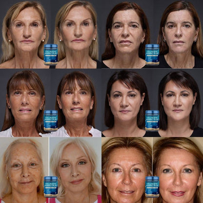 Rejuvenece en 9 Días: Colágeno Anti Age para Arrugas, Bolsas y Manchas
