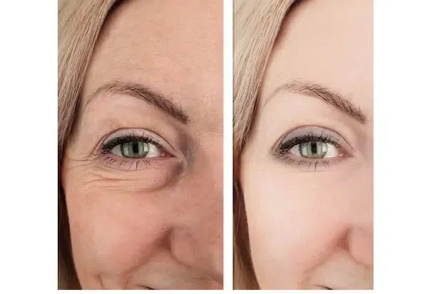 LA CREMA ANTI-EDAD ITALIANA QUE BORRA AÑOS — SIN AGUJAS, SIN CIRUGÍA