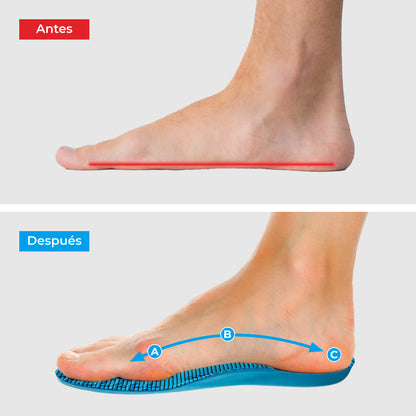 ComfyFeet Pro™ – Plantillas Ortopédicas de Alivio Total para Pies Cansados